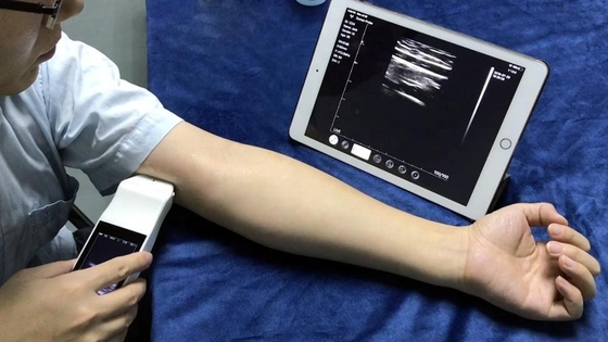 Portable wireless 7.5mhz linear doppler ultrasound probe