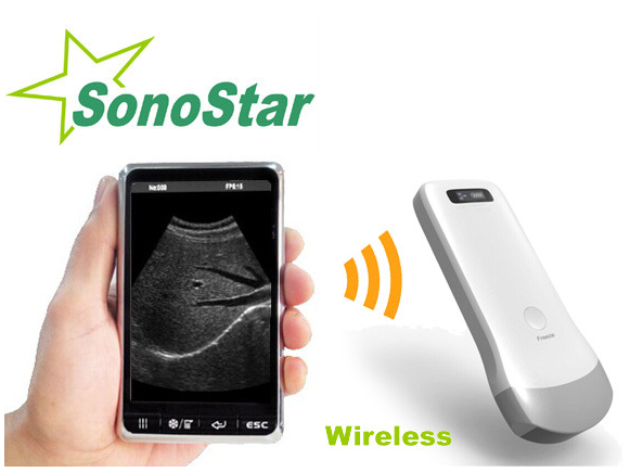 Scanner basé sur PC d'ultrason d'ordinateur portable de la machine SS-9 de l'ultrason 3D